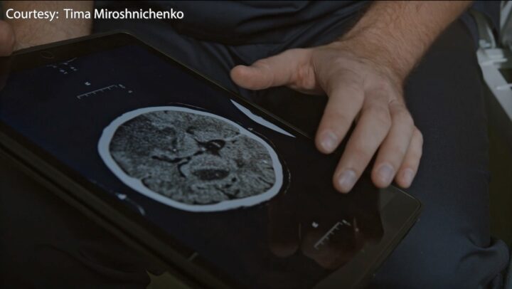 Dementia prevention and causes