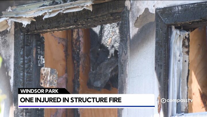 One hurt in Windsor Park fire